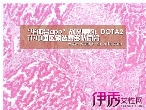 ‘华体会app’战况焦灼!DOTA2 TI7中国区预选赛多队同分(图2) 华体会